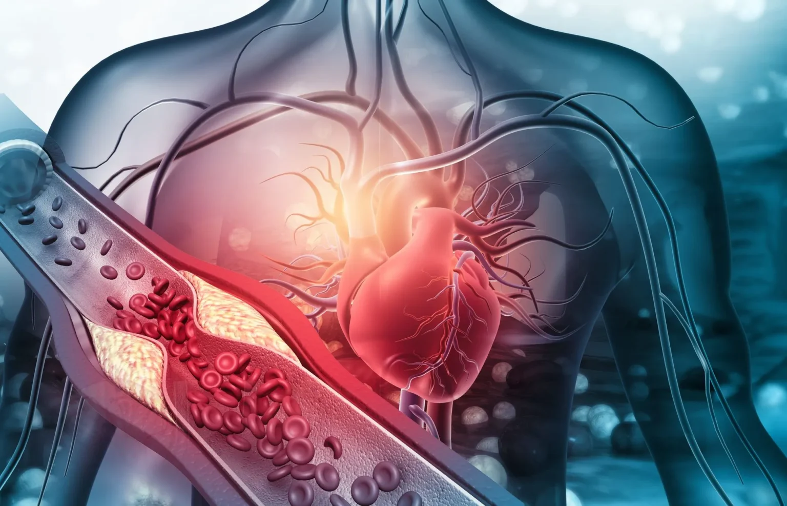 Doença Arterial Coronariana: Guia Completo Sobre Causas, Sintomas e Tratamentos doença arterial coronariana